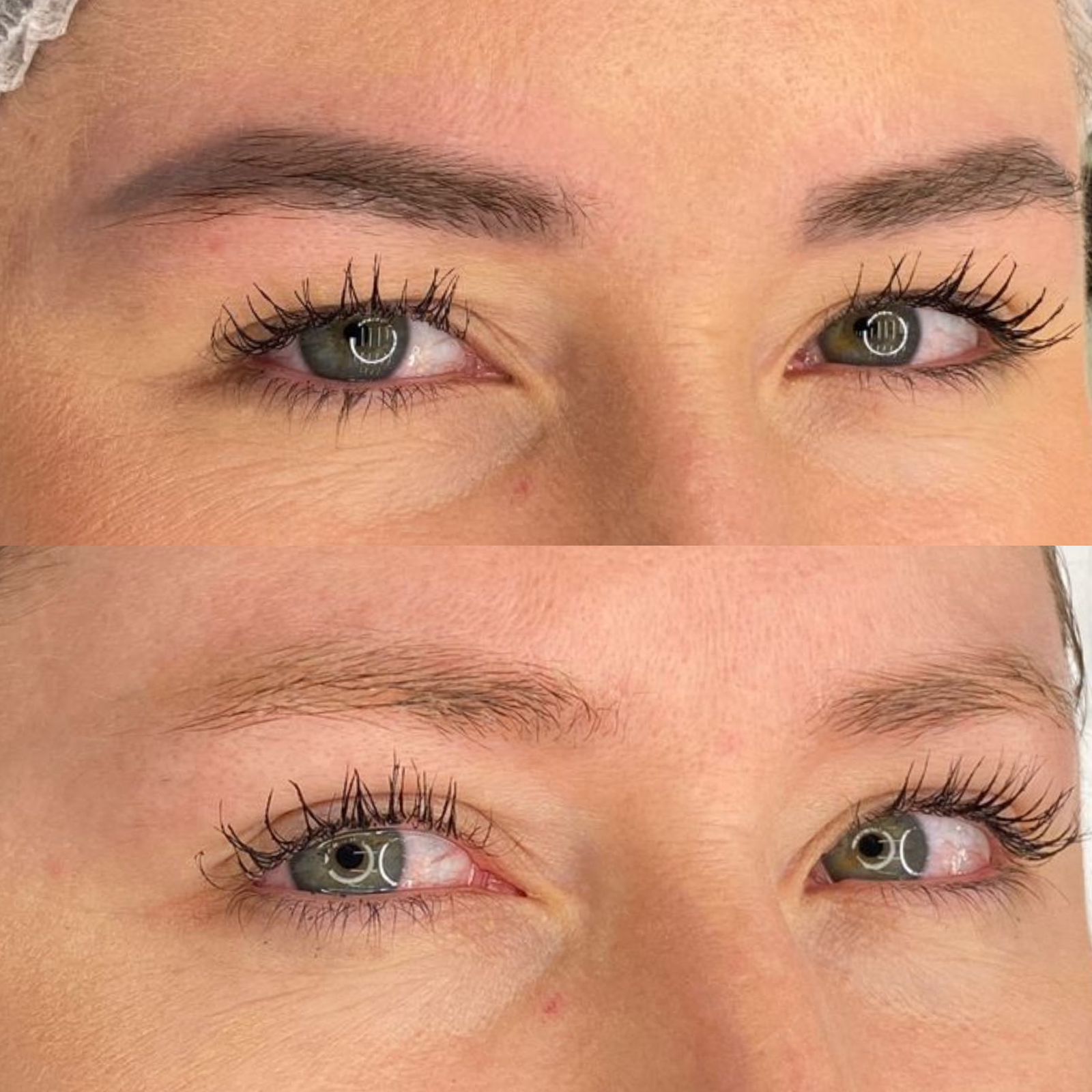 Laser Repair