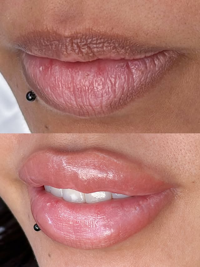 Lips