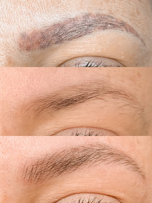 Brows